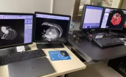 Yozgat’ta Koroner BT Anjiyografi Dönemi